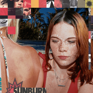 Sunburn by Dominic Fike